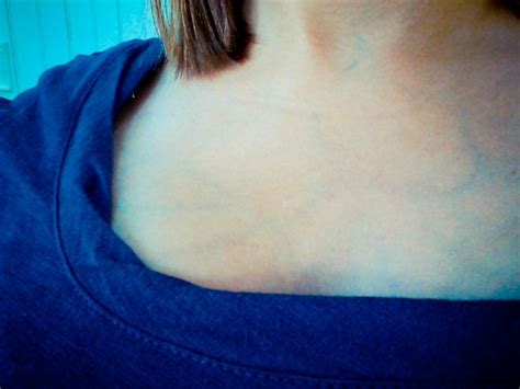 prominent blue veins in breast mega porn pics