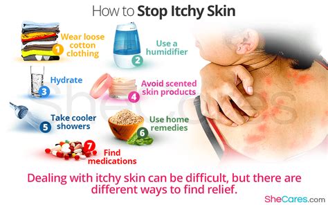 stop itchy skin shecares