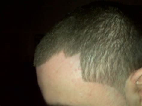 Barber Zeeked My Hairline Mad Niketalk