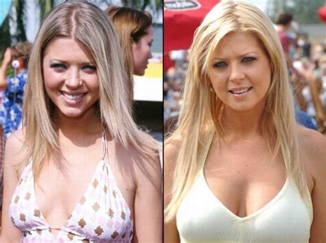 Chatter Busy Tara Reid Botched Plastic Surgery