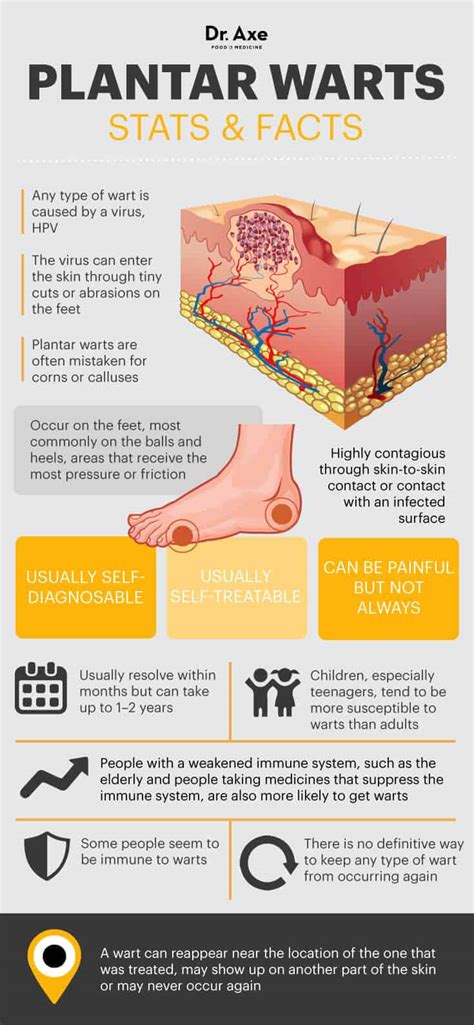 Stop Plantar Warts In Their Tracks The Natural Way Best