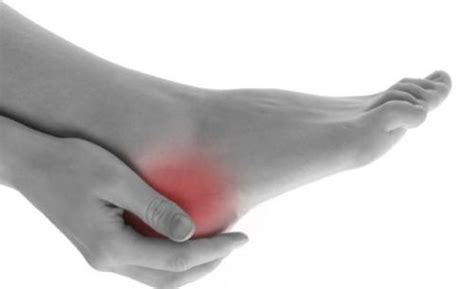 Causes Of Plantar Fasciitis With Prevention And Treatment