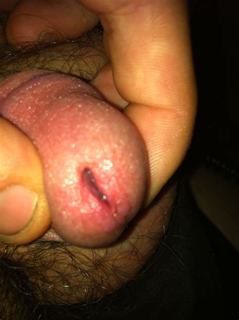 penis pee hole first butt sex