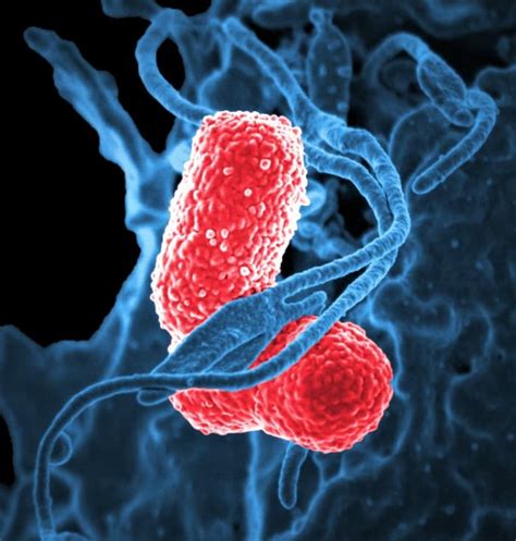 klebsiella pneumoniae facts  effects  discoveries owlcation