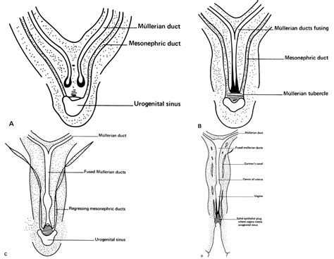 volume 1 chapter 4 developmental abnormalities of the female reproductive organs