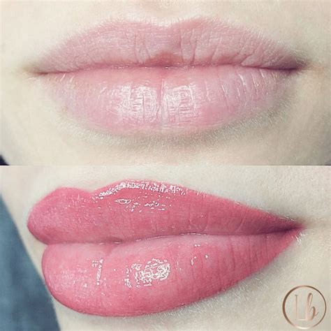 lip filler  lip blushing  procedure  choose