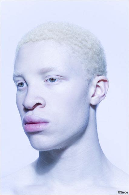 hot albino models black albino model  katy perrys  inspiration pinterest