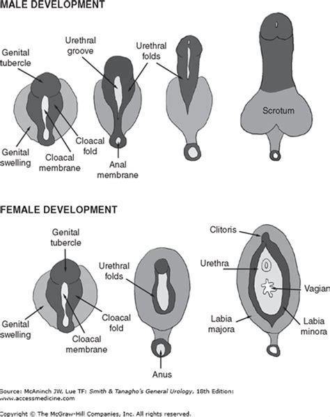 disorders of sex development abdominal key