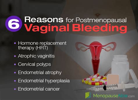 Postmenopausal Bleeding All You Need To Know About Bleeding After My