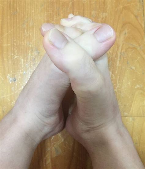 Internet’s Going Crazy Over This Girl Who Has Toes As Long As Fingers