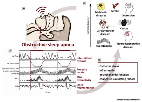 Obstructive Sleep Apnea And Hallmarks Of Aging Trends In Molecular