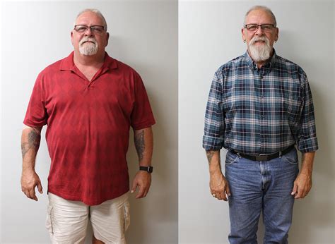 David S Weight Loss Transformation St Louis Bariatrics
