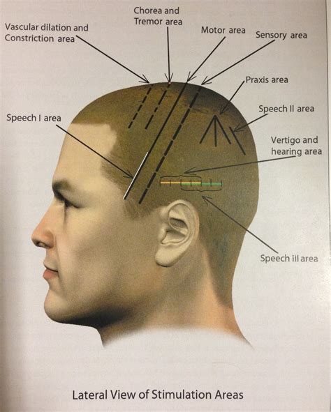 scalp acupuncture vinci health nyc