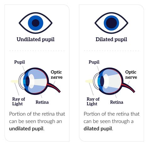 dilated eye exam national eye institute