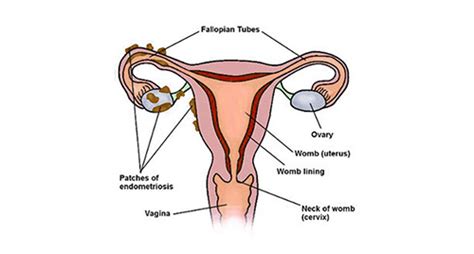 women health mygyno obstetric and gynecology kenya mygyno