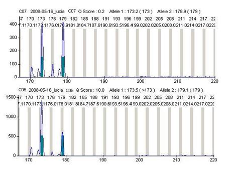 humandrec amplification of patient s mother dna showing alleles 173 and download scientific