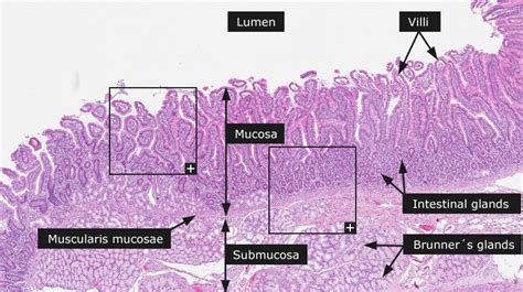 dictionary normal duodenum  human protein atlas