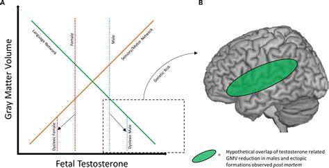 Frontiers Neurobiological Sex Differences In Developmental Dyslexia