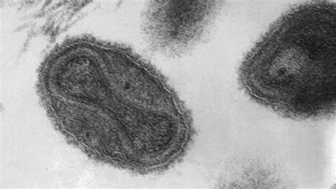 grants smallpox  reprieve shots health news npr