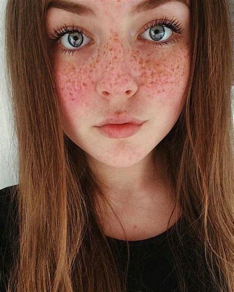Girls With Freckles 27 Pics