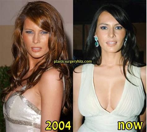 Pin On Beforeandafter Famous Faces