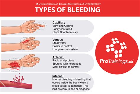 main types  bleeding