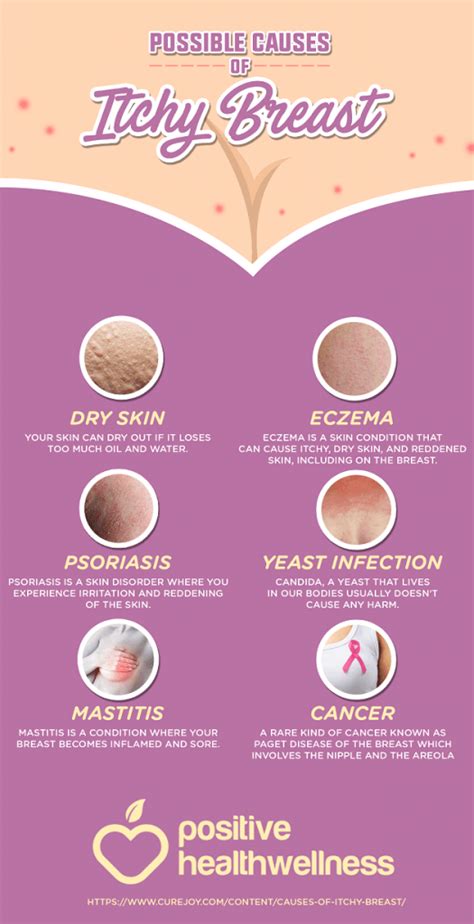 6 Possible Causes Of Itchy Breasts – Infographic – Positive Health Wellness