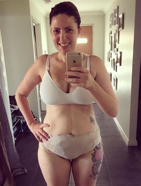 this mom posts pics of her ileostomy pouch to encourage self love self