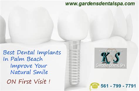 invisalign gardens dental spa
