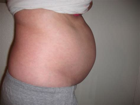 extreme bloating what causes the belly to bloat severely