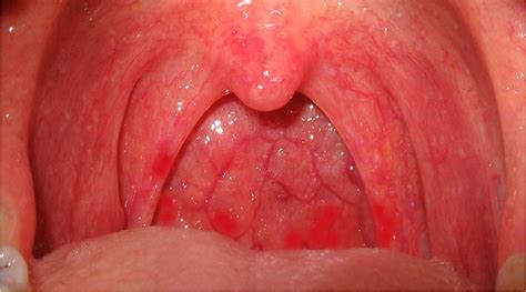 Throat Extreme Deepthroat Blowjob