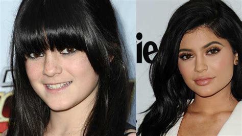 kylie jenner plastic surgery timeline before and after pictures celebrity heat