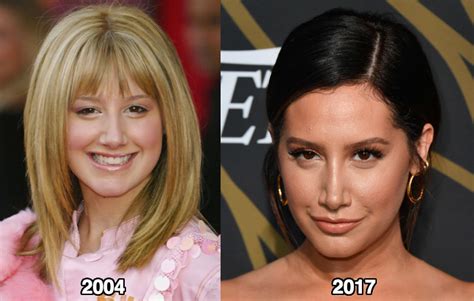 Ashley Tisdale Nose Job Before And After Photos Latest
