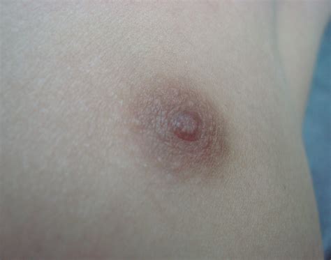 Shemale breast buds