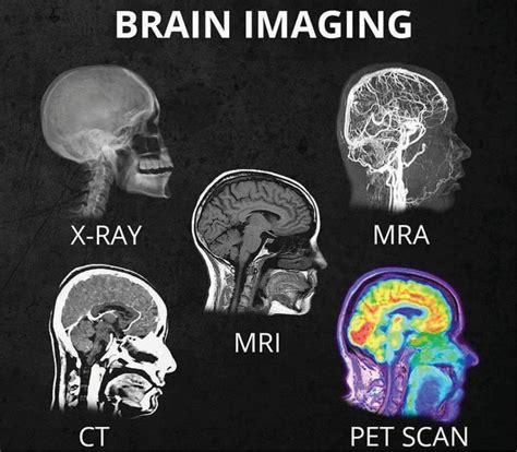whats  difference     head scans  ray ct