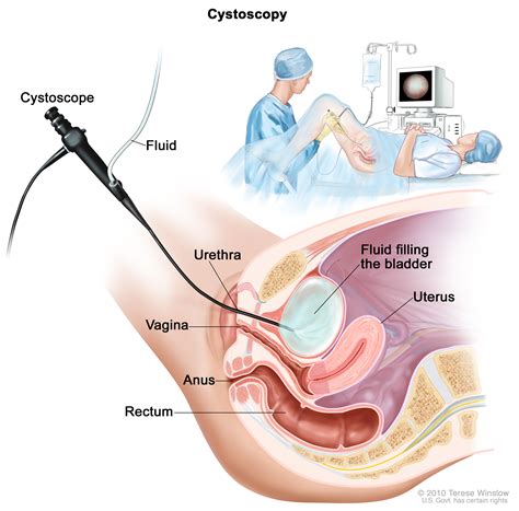 Camera inside birth canal
