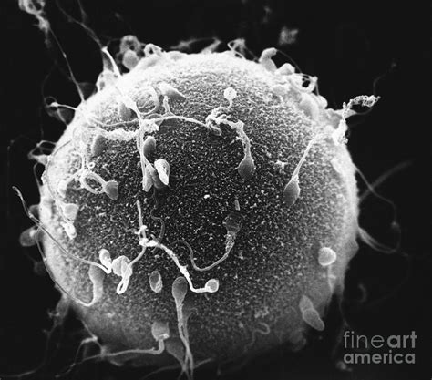 Human Sperm And Hamster Egg Sem Photograph By David M