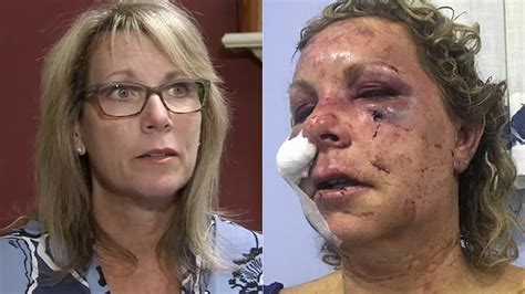 tammy lawrence daley shares story of survival after dominican republic vacation attack