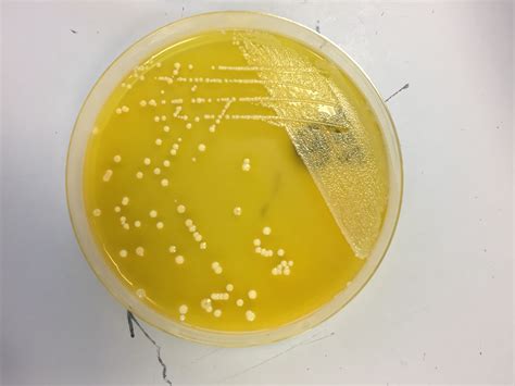 ecoli  xld  isolated  subcultured    wastewater