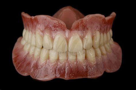 unterschiedliche interpretationen einer totalen prothese  dentale bilder mc zahntechnik