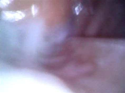 Deep Look Inside Cum Filled Ass With Endoscope Free Porn