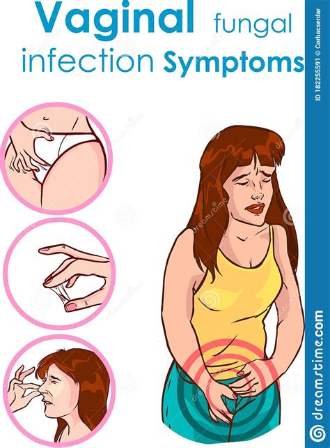 Vaginal Fungal Infection Symptoms Vector Illustration