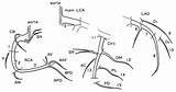 Coronary Arteries Velocity Pressure Circulation Arterial Angiographically Ecg sketch template