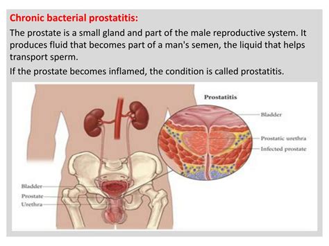Ppt Lower Urinary Tract Infection Powerpoint Presentation Free