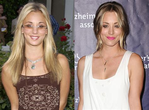 celebrities who have admitted to plastic surgery page 4 the