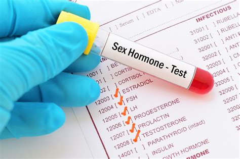 associations between sex hormones and asthma in adults pulmonology