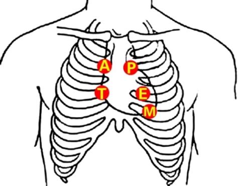 Figure 1 Five Auscultation Locations Of Heart Sounds Spectrum