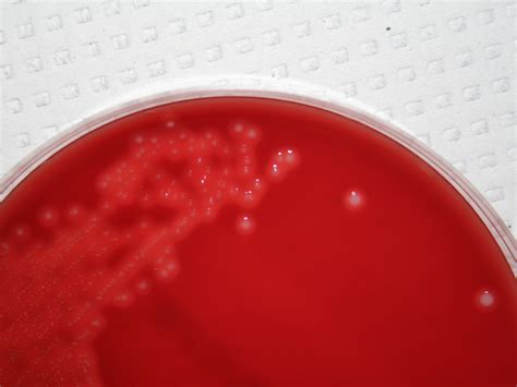 Streptococcus Agalactiae Virtual Lab Microbiology