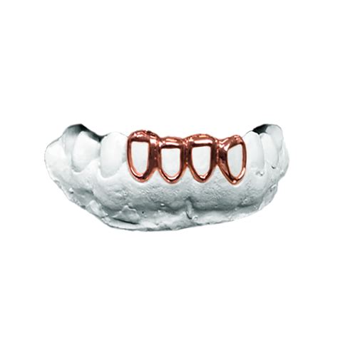 rose gold open grillz cnj gold teeth