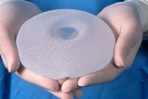 9 deaths are linked to rare cancer from breast implants the new york